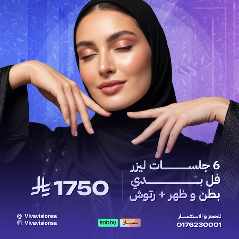 فيفا فيجن