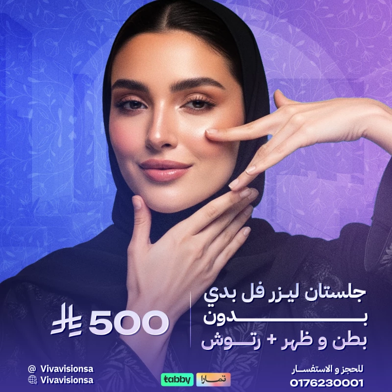 فيفا فيجن