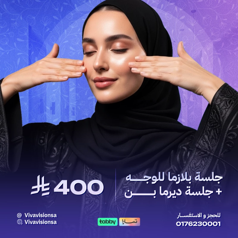 فيفا فيجن
