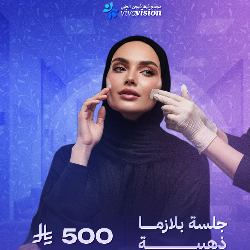 فيفا فيجن