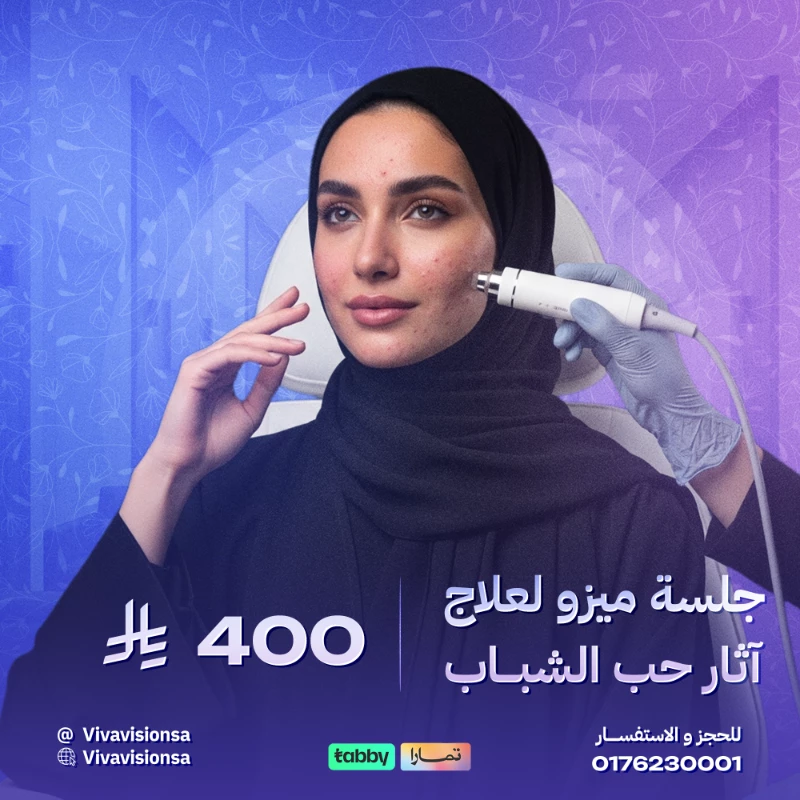 فيفا فيجن