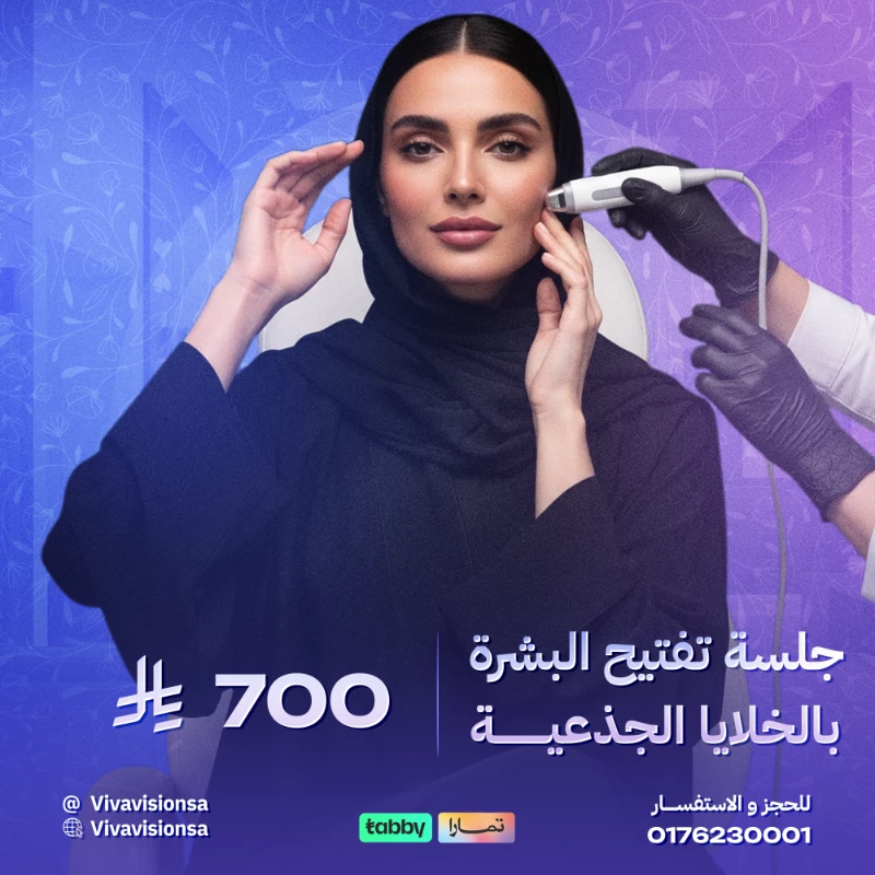 فيفا فيجن