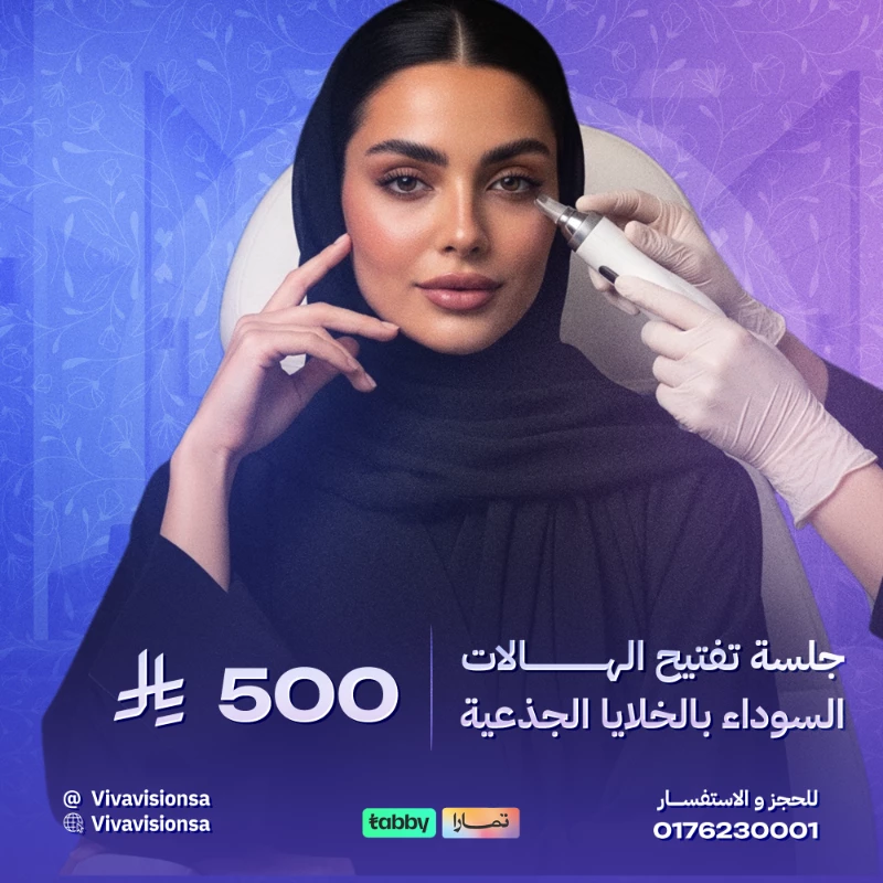 فيفا فيجن