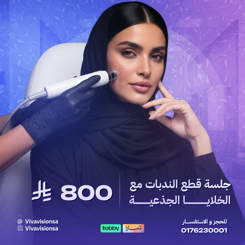 فيفا فيجن