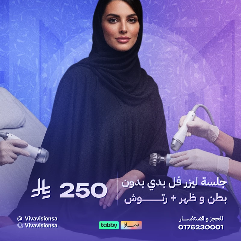 فيفا فيجن