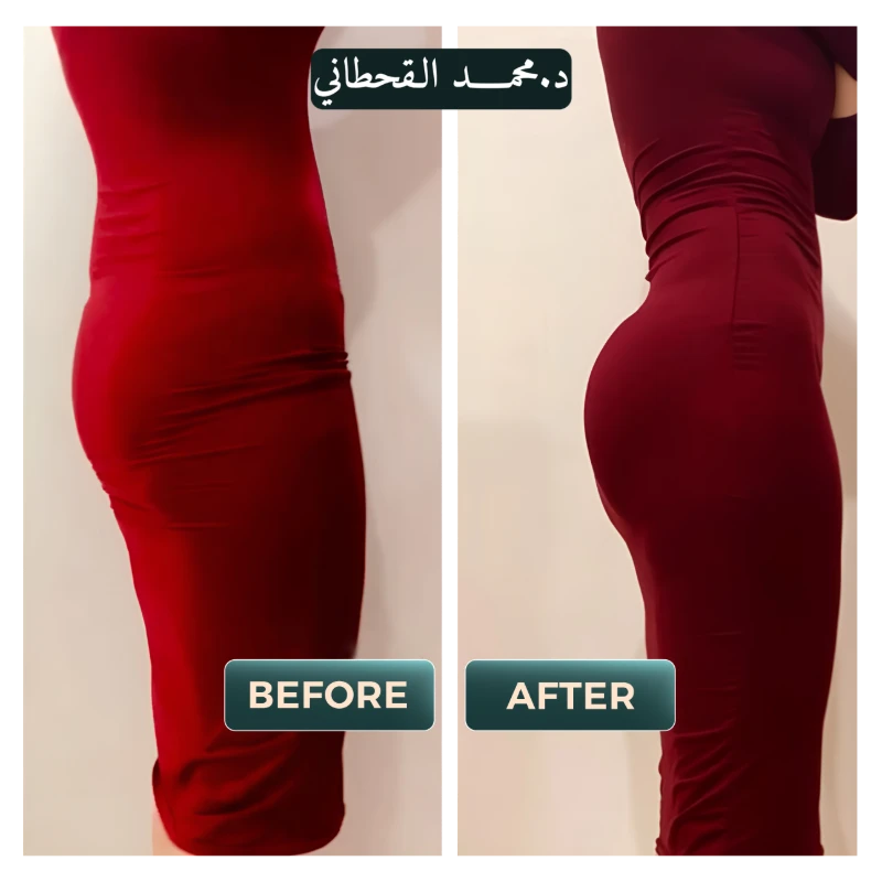 حالات قبل وبعد