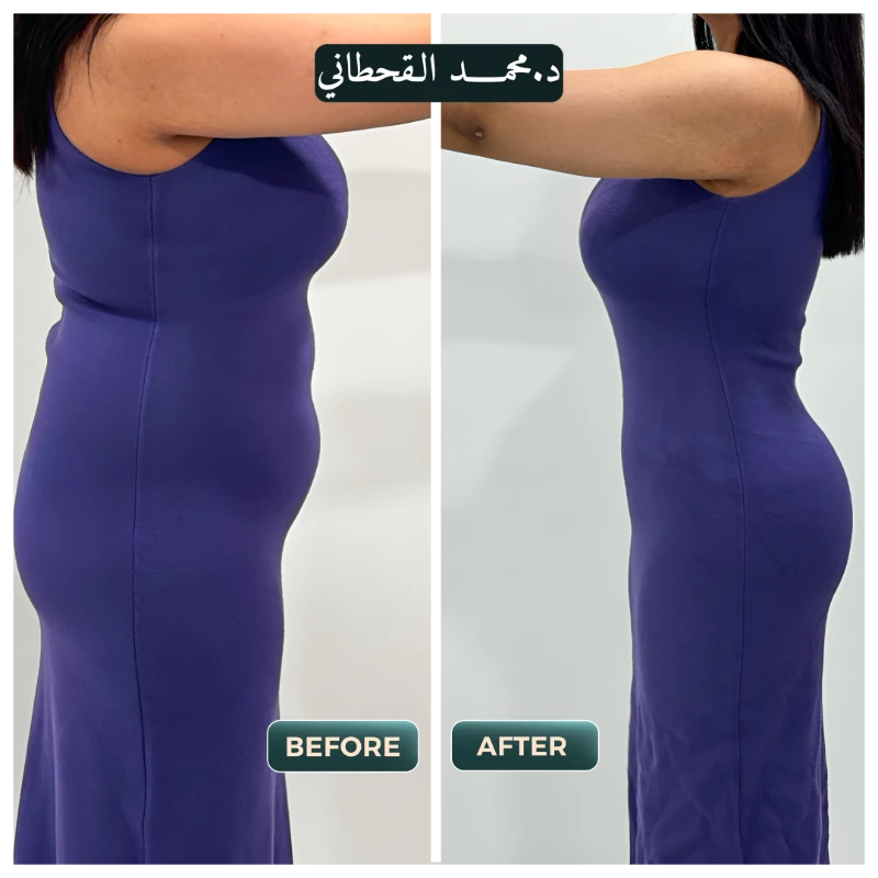 حالات قبل وبعد