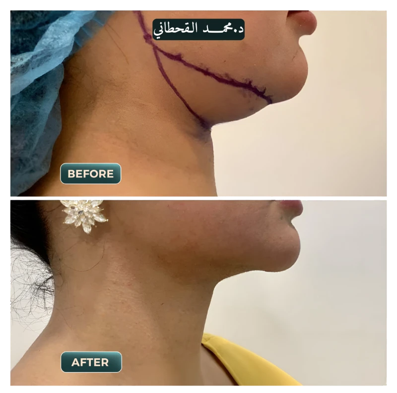 حالات قبل وبعد
