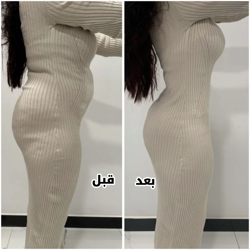 حالات قبل وبعد