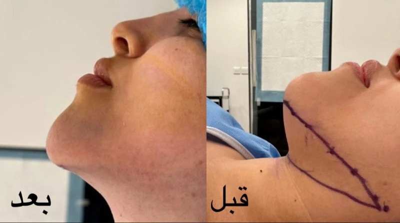 حالات قبل وبعد