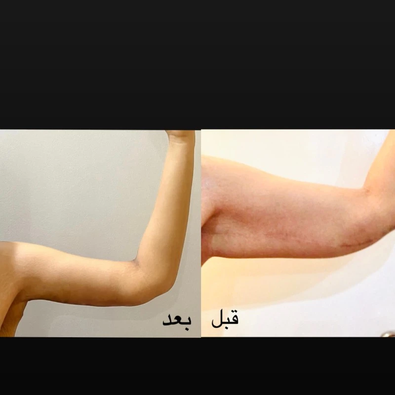 حالات قبل وبعد