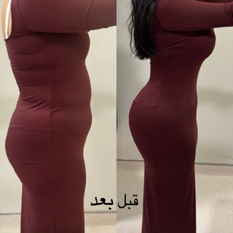 حالات قبل وبعد