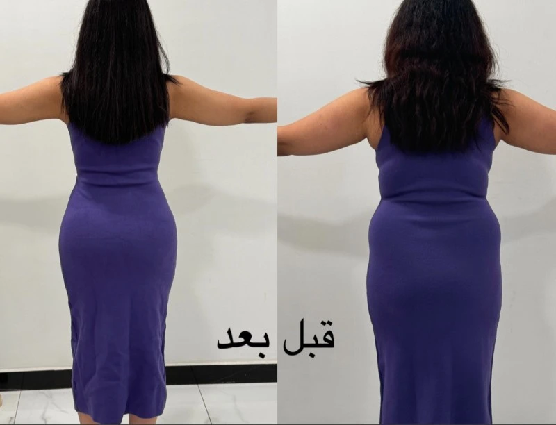 حالات قبل وبعد